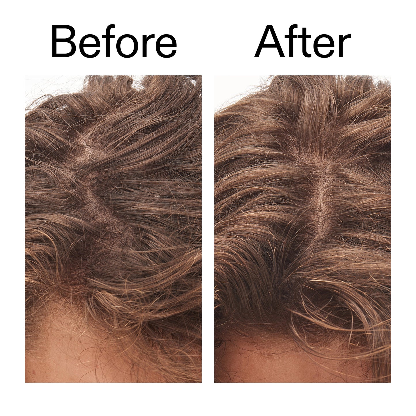 glycolic-acid-exfoliating-scalp-scrub-m5 Glycolic_Acid_Exfoliating_Scalp_Scrub_Before_After_2000x2000_b8561c87-05a1-4caa-80f7-1b6b33d750f7.jpg