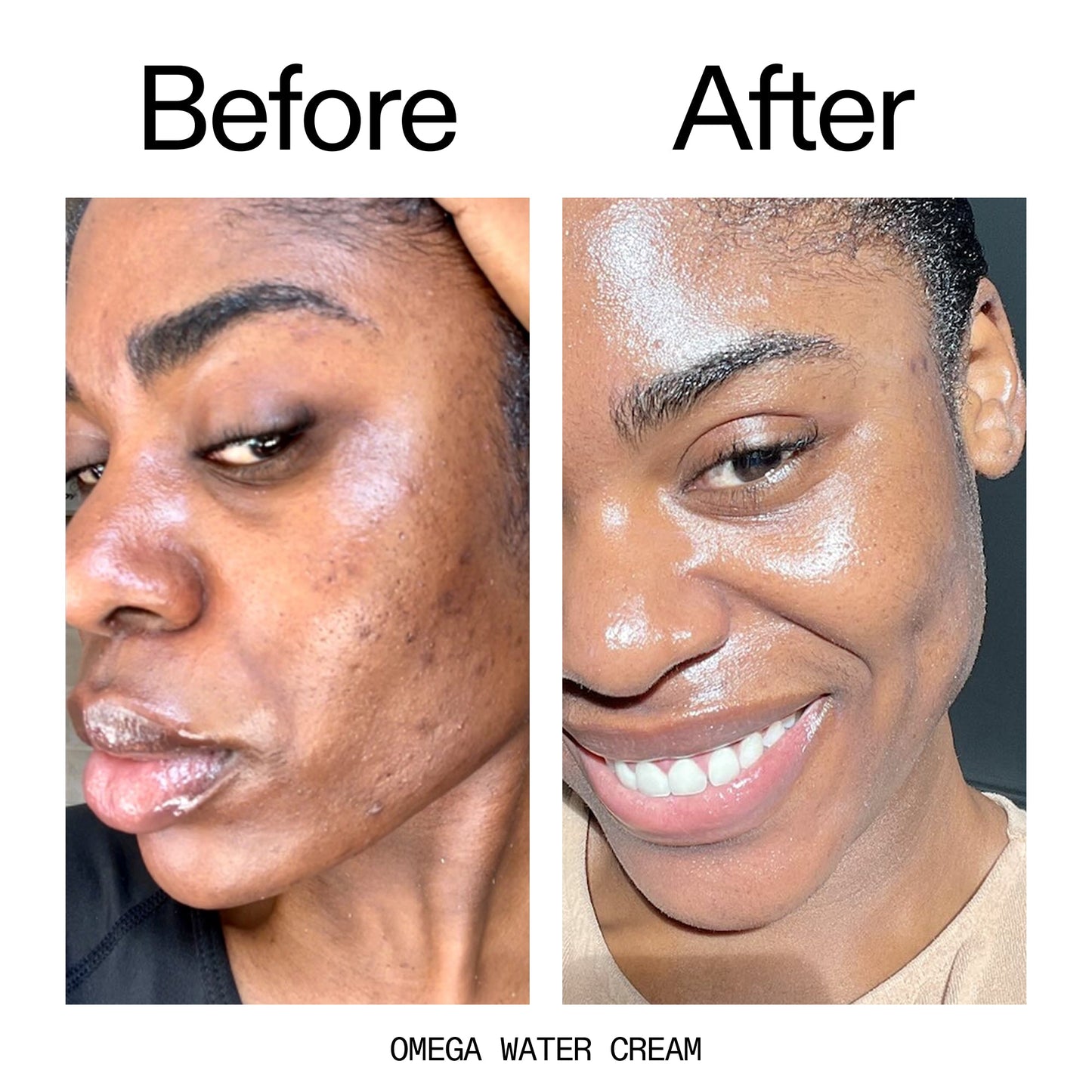 hydrating-cleanser-and-moisturizer-duo-k7 Omega_Water_Cream_Before_After_2000x2000_8e88278b-8c8d-48dc-ac77-4e98ebbd1b77.jpg