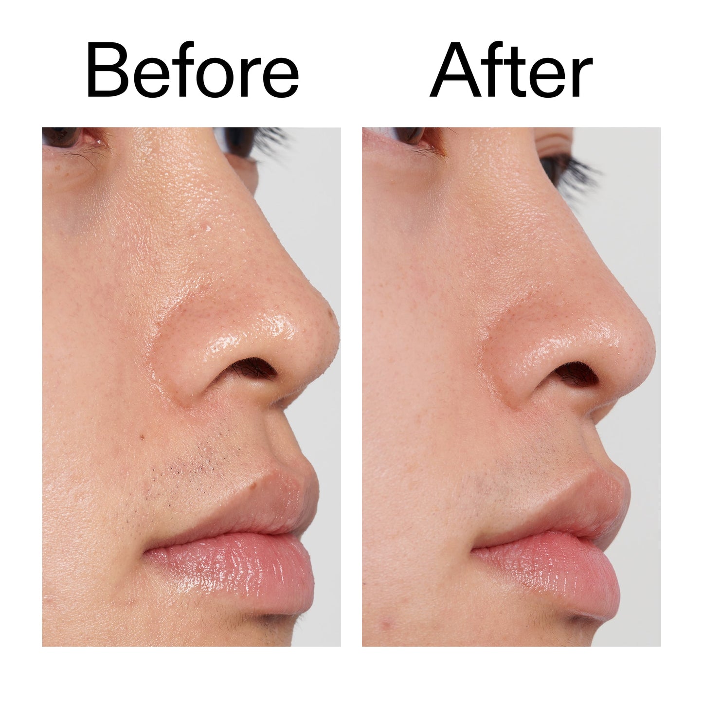 pha-toner-g3 PHA_Toner_Before_After_2000x2000_e3c10172-0150-4342-8b95-57417eaff50d.jpg