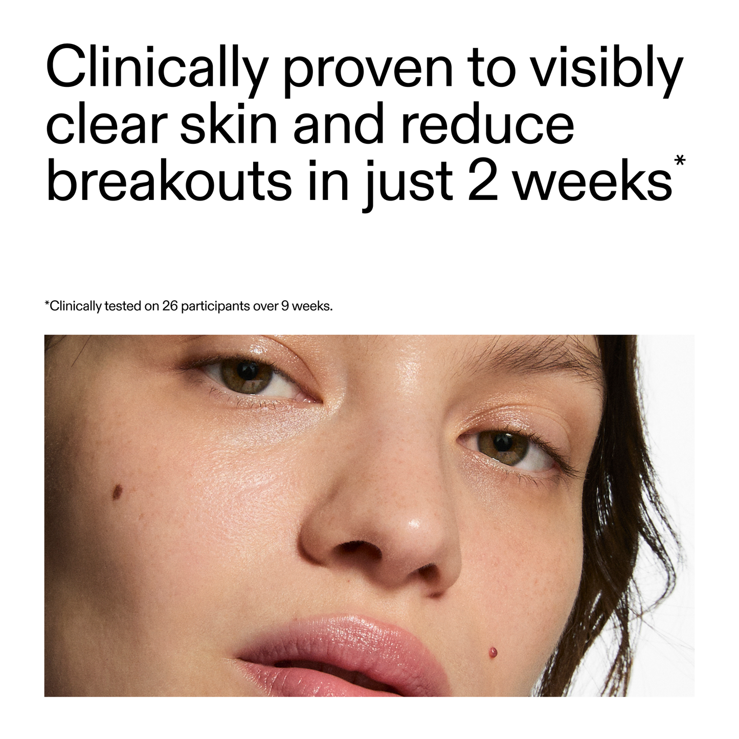 360-acne-clearing-serum-d2 360_Serum_Key_Claim.png