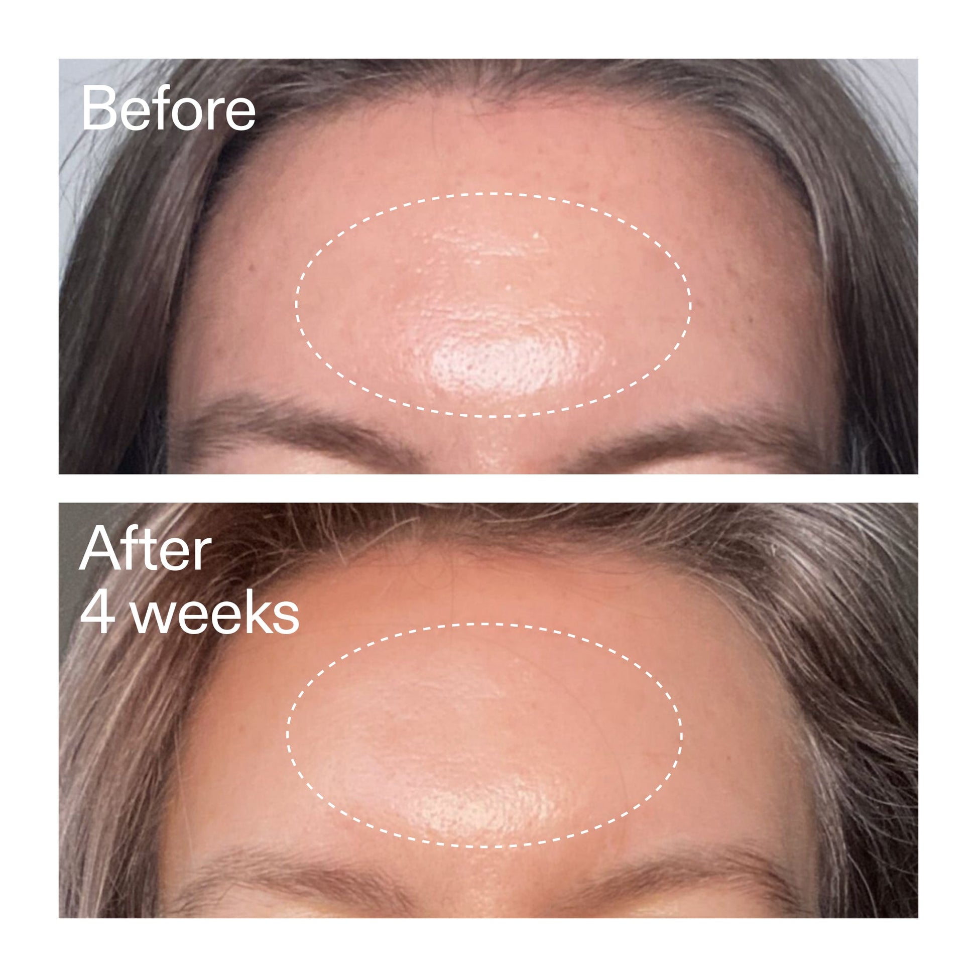 advanced-0-2-retinal-serum-duo-k7 AdvancedRetinal_BeforeAfter1_2000x2000_4e9c798a-f30e-45b8-a34a-7c4740f2f2cb.jpg