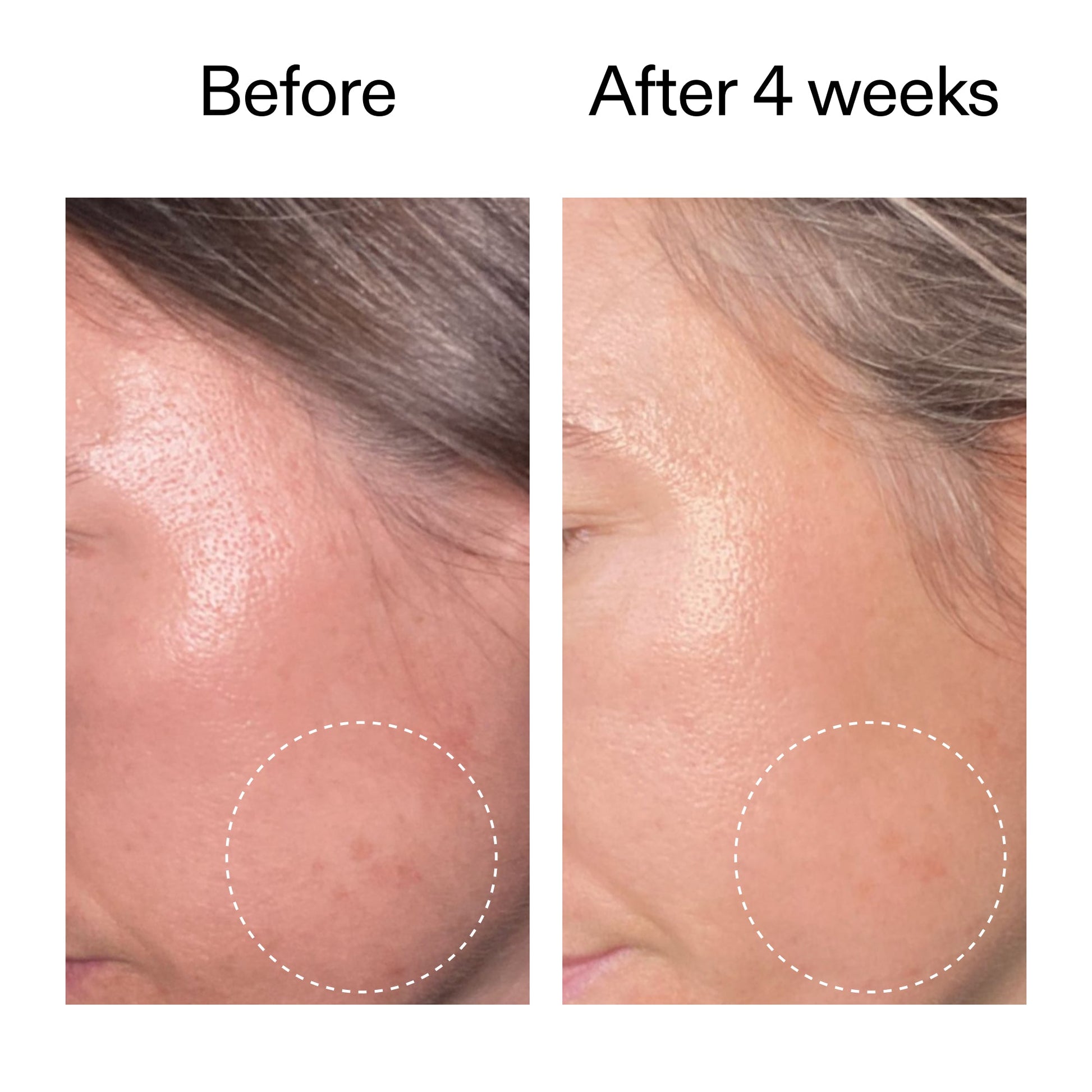advanced-0-2-retinal-serum-f3 AdvancedRetinal_BeforeAfter2__2000x2000_62fb16bb-77ae-4d63-8500-88dbf847f4b9.jpg
