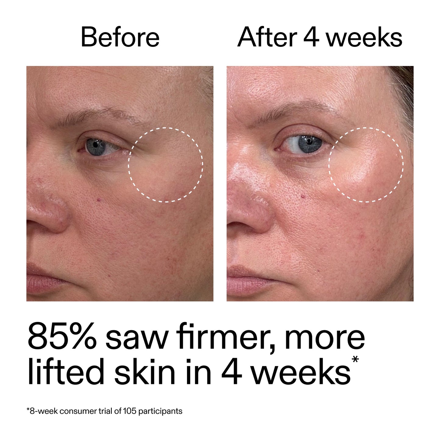 advanced-0-2-retinal-serum-f3 AdvancedRetinal_BeforeAfter_Claim1_2000x2000_bcc385c4-5e73-4f1e-aba8-64267937d0d3.jpg