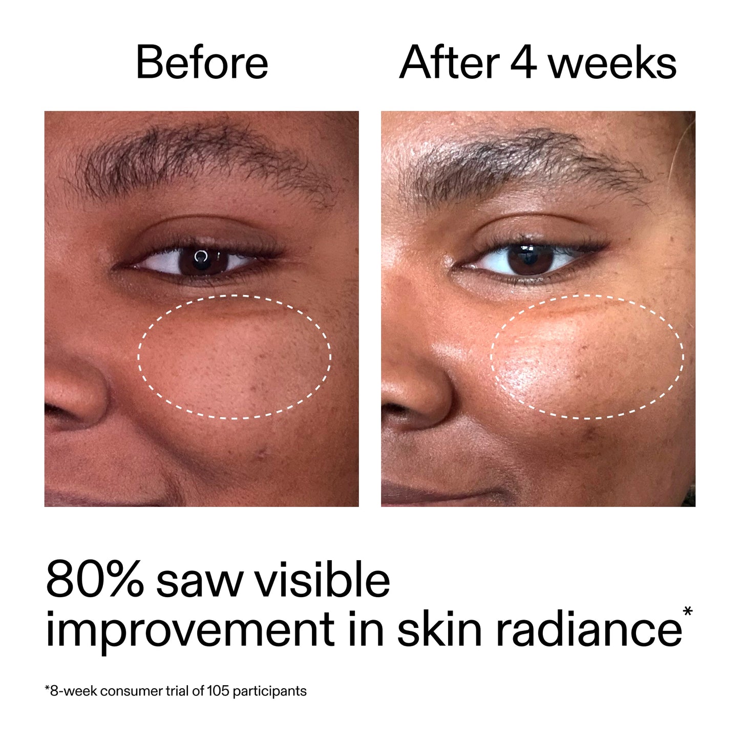 advanced-0-2-retinal-serum-f3 AdvancedRetinal_BeforeAfter_Claim2_2000x2000_39d11e3d-eda9-44ec-ab32-2903b1a368bd.jpg
