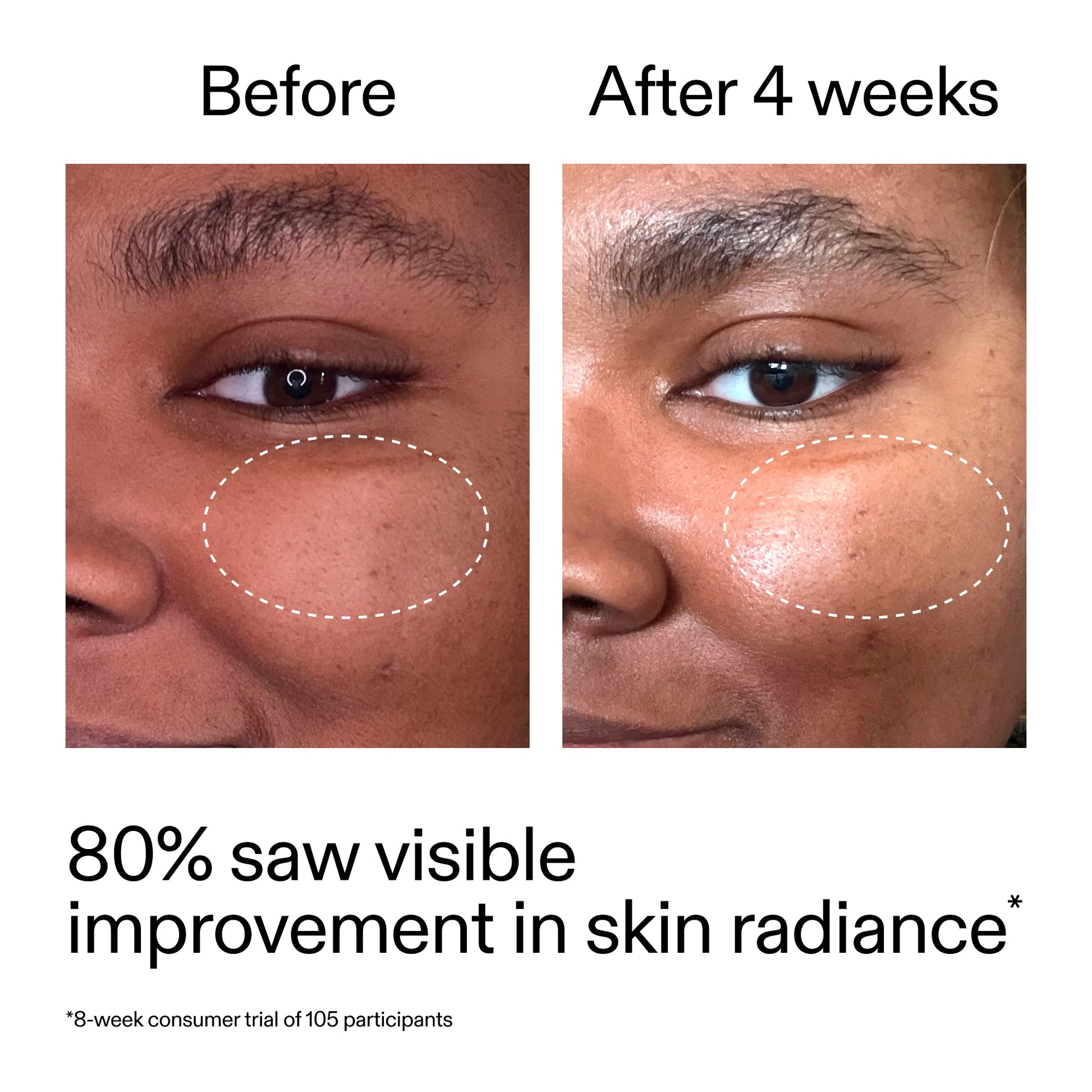 advanced-0-2-retinal-serum-duo-k7 AdvancedRetinal_BeforeAfter_Claim2_2000x2000_681b621d-8d44-4d44-9a40-89244f9b2e53.jpg