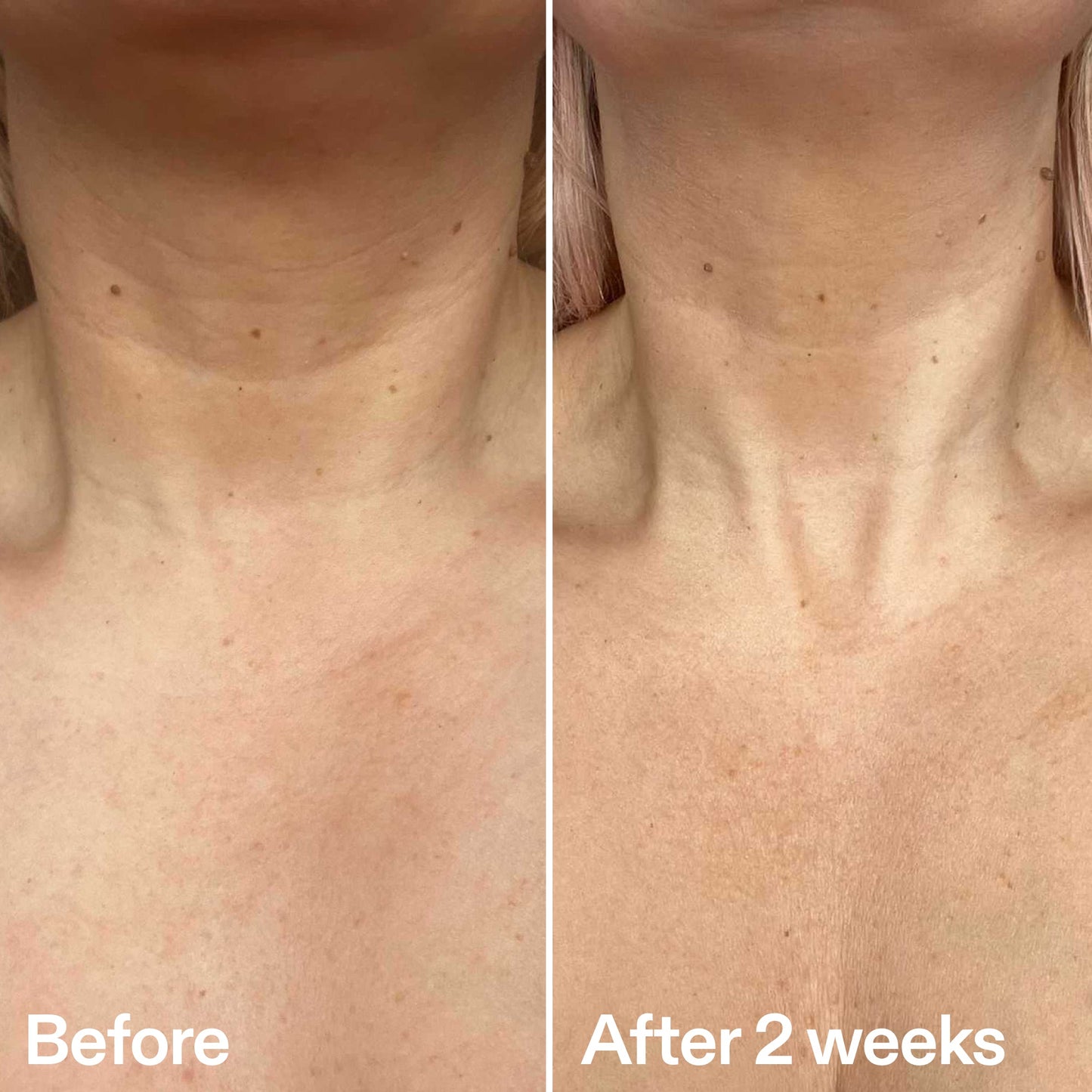 bio-active-neck-lift-stick-z7 B_A_2.jpg