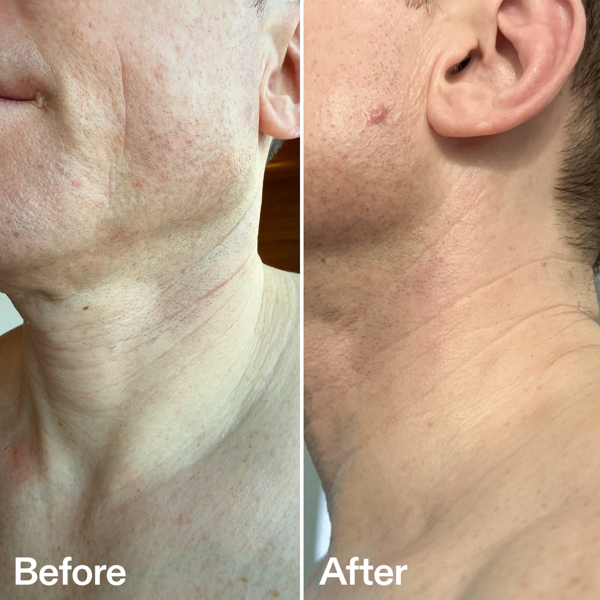 bio-active-neck-lift-stick-z7 B_A_afa2743e-b8e2-4504-92f4-e281cb6cf759.jpg