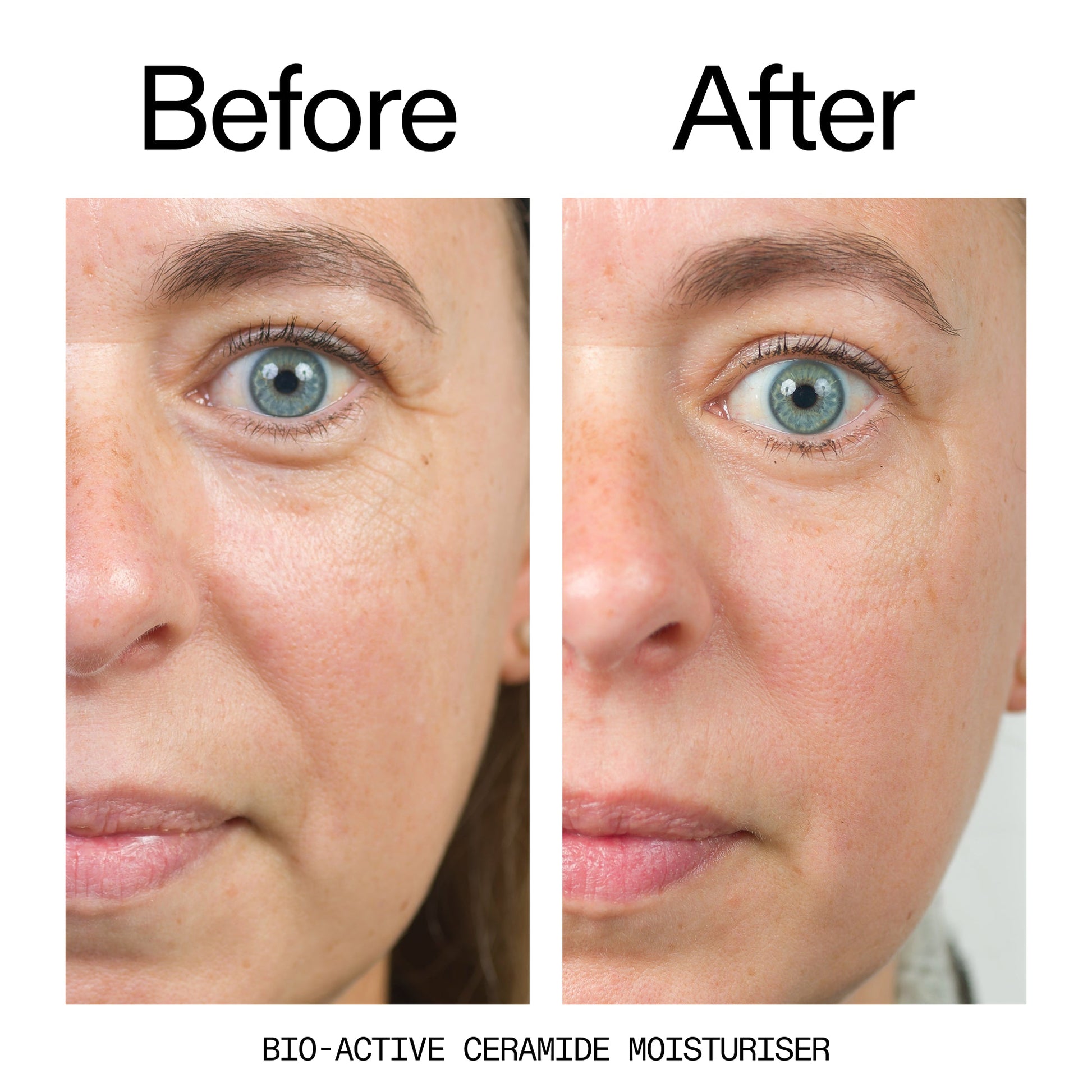 barrier-boosting-trio-n0 Bio-Active_Before_After_2000x2000_600947b4-e8c5-425a-9155-fc15bc83aa12.jpg