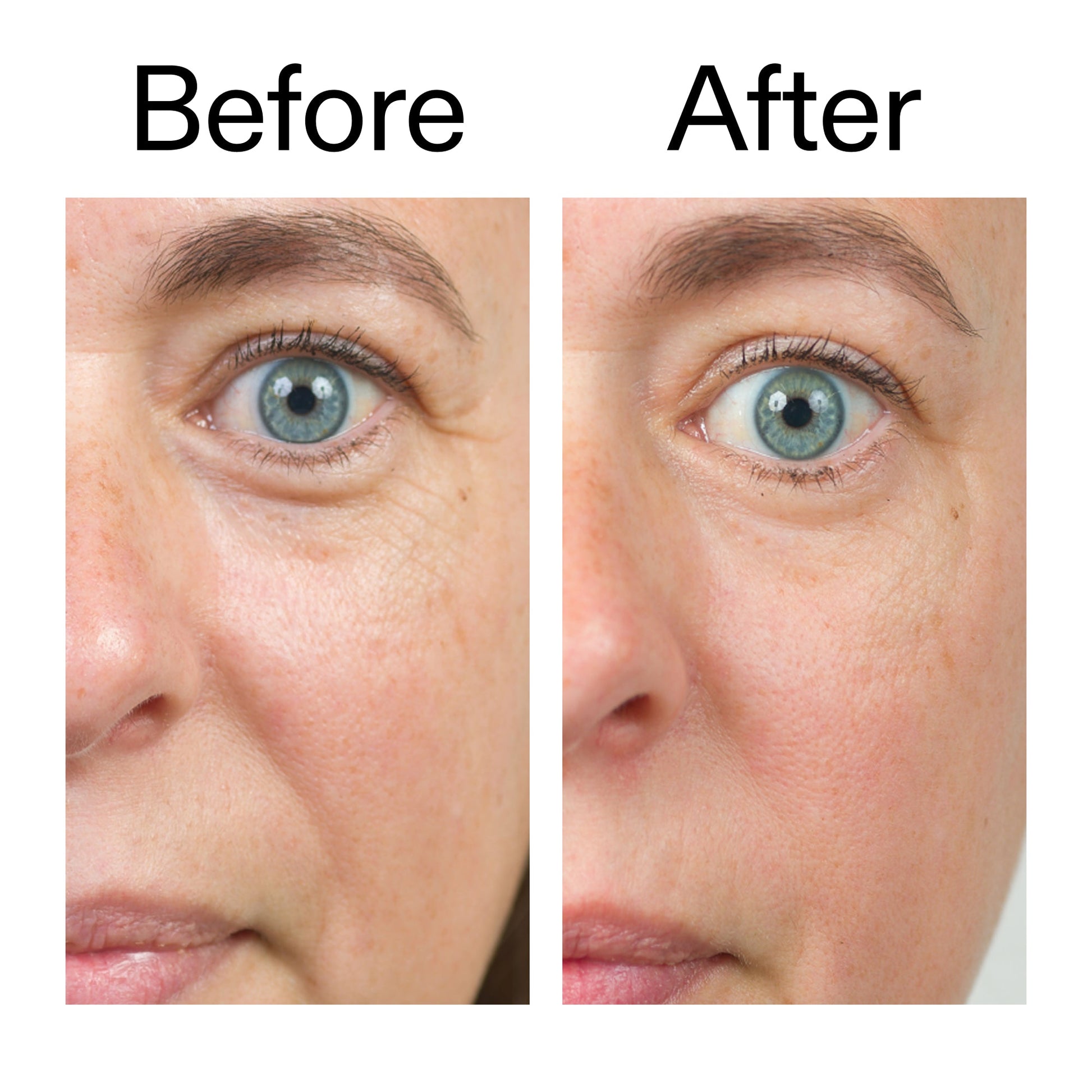 bio-active-ceramide-moisturizer-h8 Bio-Active_Before_After_2000x2000_566e5a9e-135e-417a-8242-b44e5fa35463.jpg