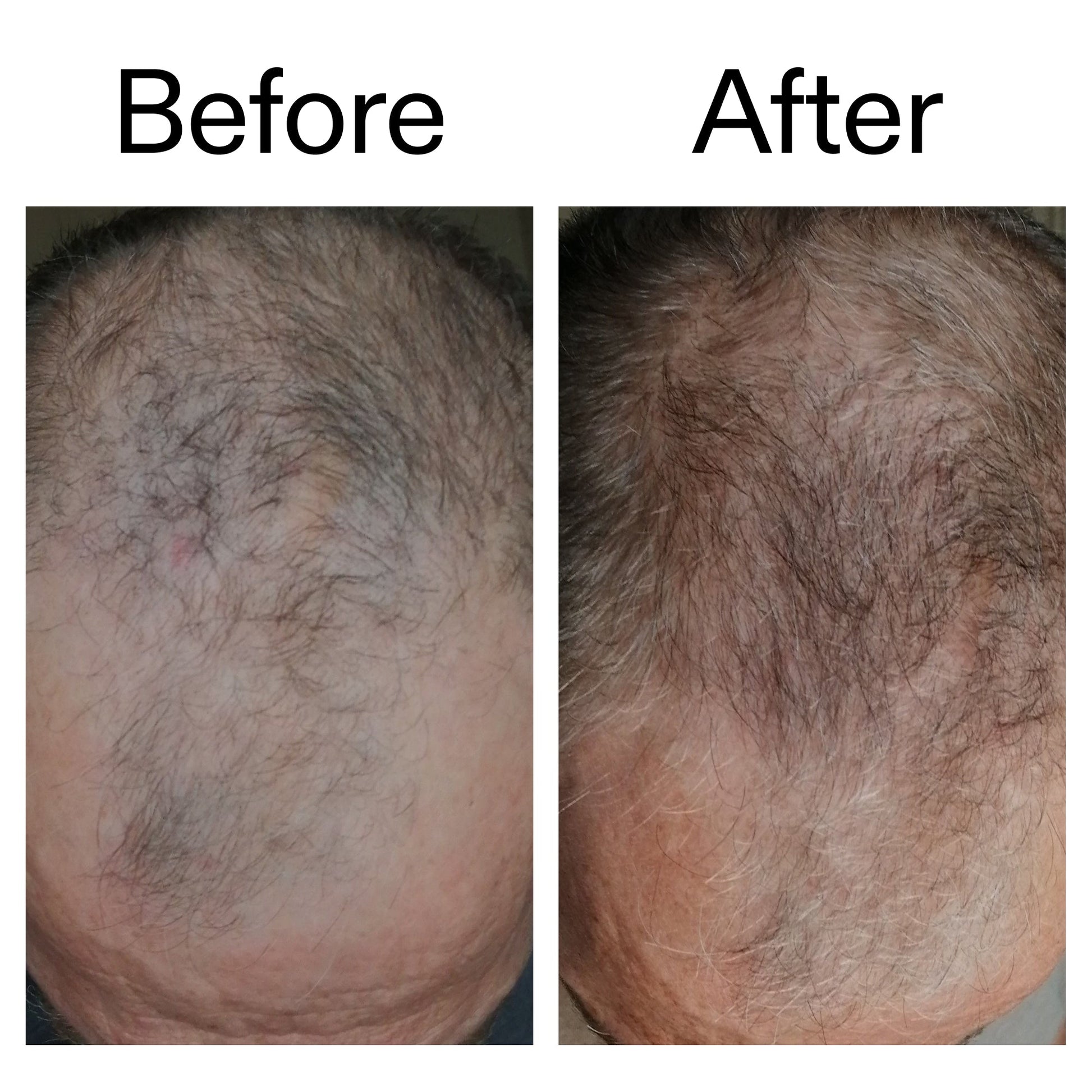 3-month-hair-growth-trio-w2 Caffeine_Scalp_Treatment_B_A_Ppage_2000_x_2000.jpg