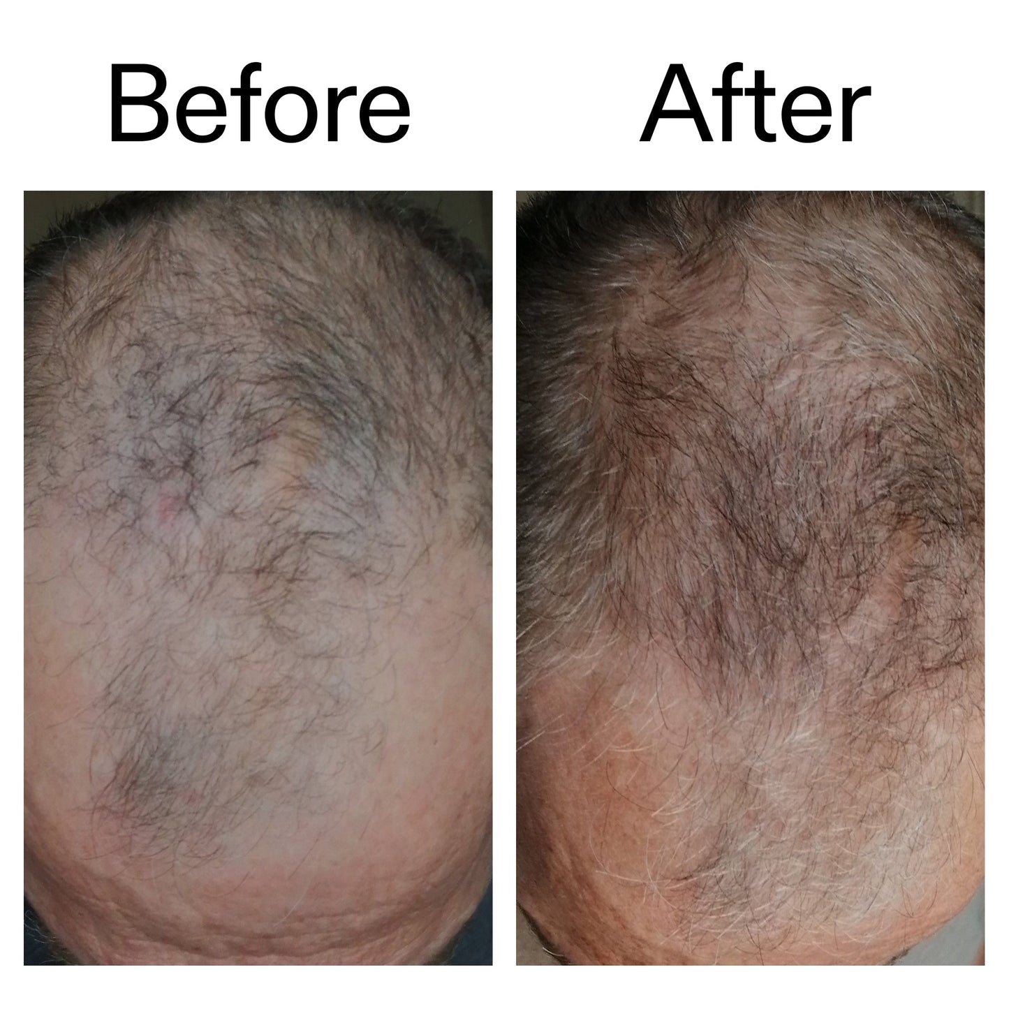 caffeine-stimulating-scalp-treatment-o3 Caffeine_Scalp_Treatment_B_A_Ppage_2000_x_2000.jpg