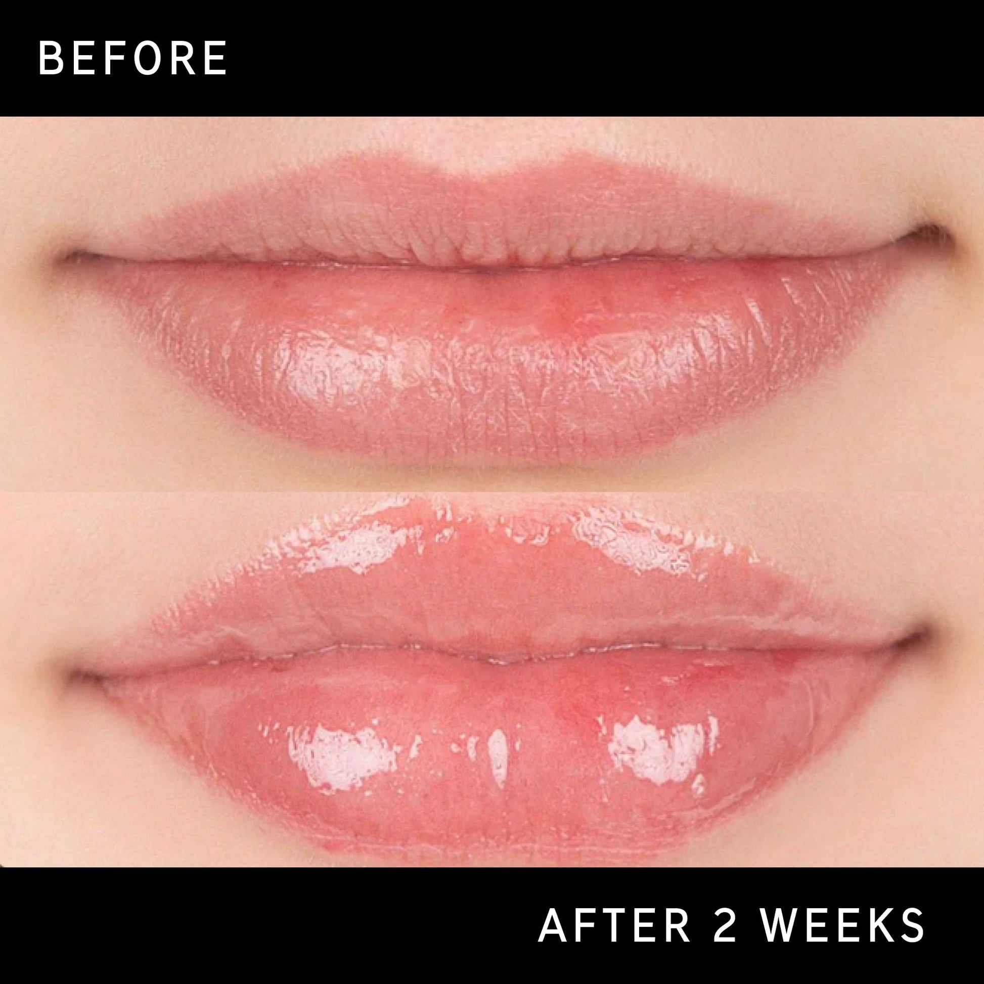 lip-plumping-duo-r0 DTC-Top15_Amends_Tripeptide-Lip_B_A.jpg
