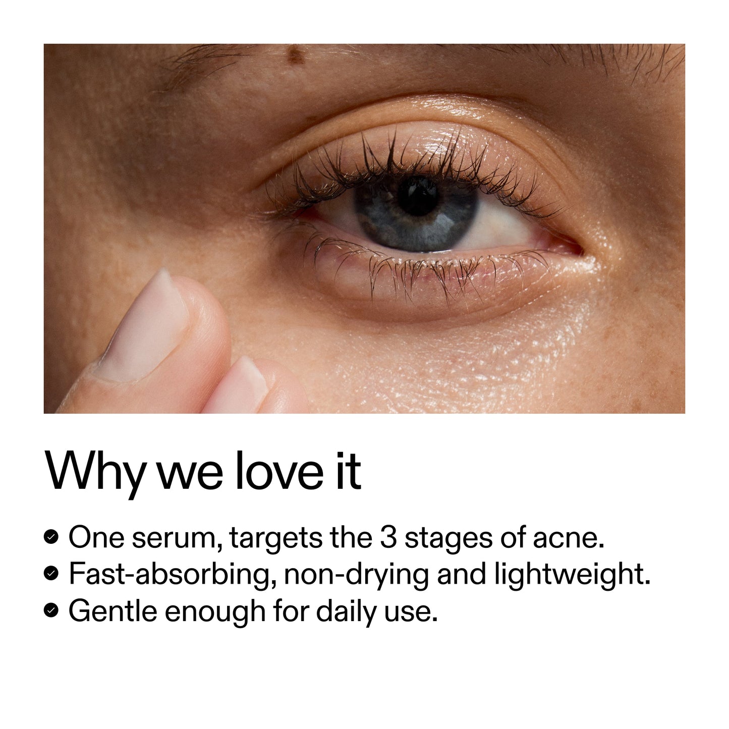 360-acne-clearing-serum-d2 Dioic_Whyweloveit_2000x2000_175aafd3-0cbe-403a-b317-a8362881bfe2.jpg