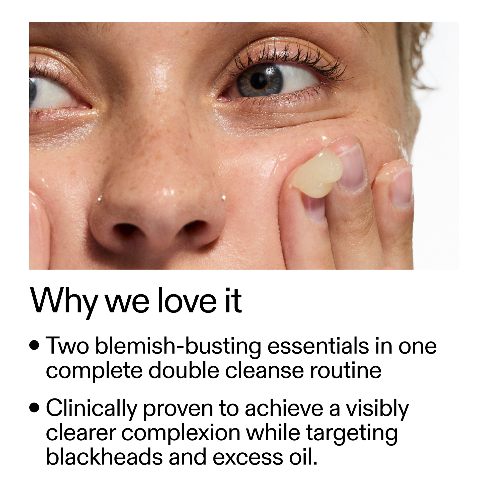 acne-double-cleanse-duo-f8 Double_Cleanse_Duo_for_Breakouts_Why_We_2000x2000_f242cb12-bb5c-487c-b203-071ccb406ec5.png