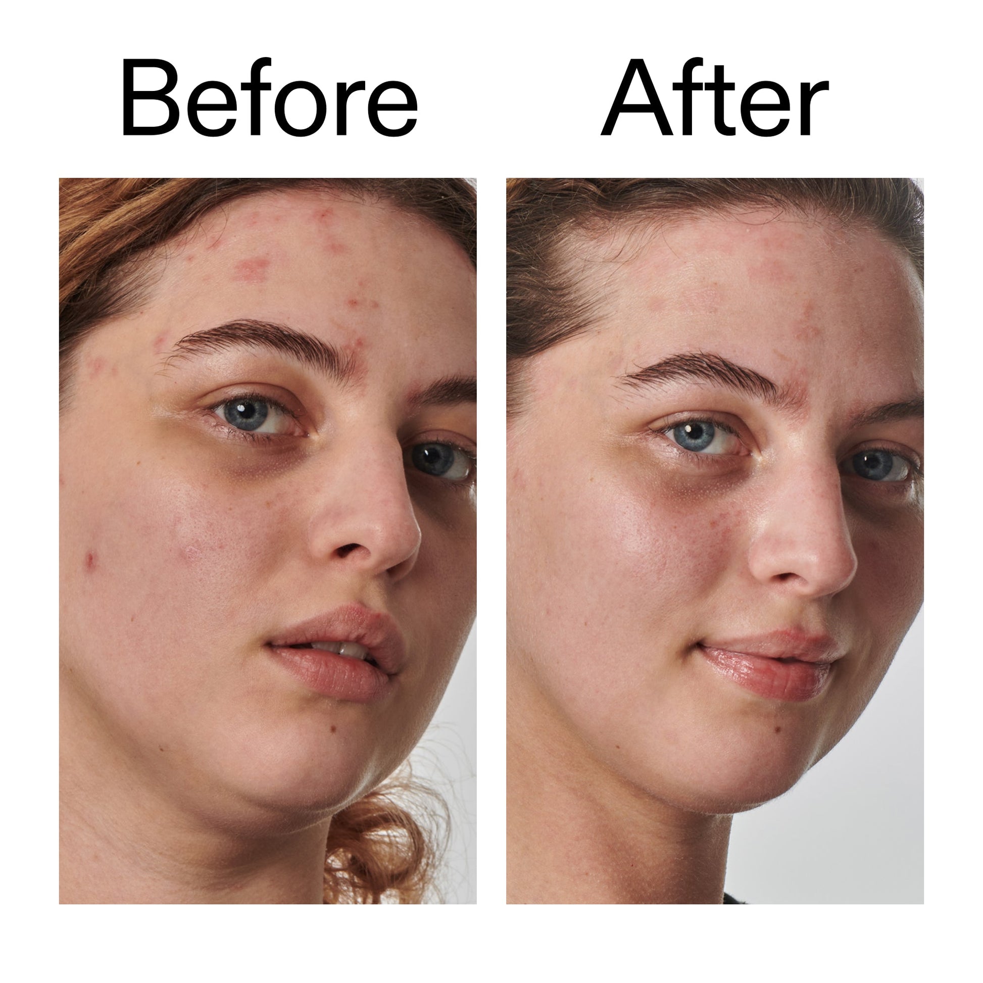 10-urea-moisturizer-s8 Dry_and_Rough_Skin_Solution_Before_After_2000x2000_efa6e639-5c39-49bd-a5dd-f0220293120a.jpg