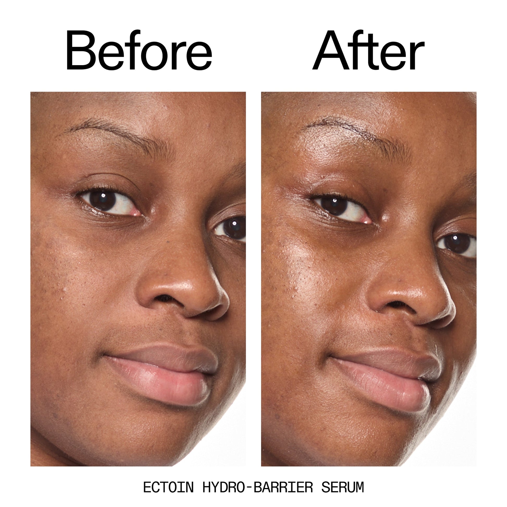 barrier-boosting-trio-n0 Ectoin_Before_After_2000x2000_ce35bc41-4da0-4b6f-adc7-29f8641f6c6c.jpg