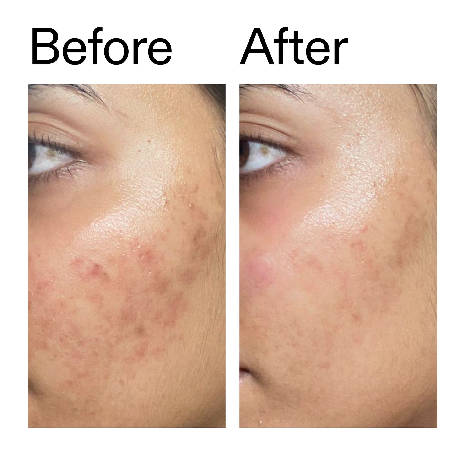 ectoin-hydro-barrier-serum-duo-k9 Ectoin_Hydro-barrier_Serum__Before_After_2000x2000_34261920-d004-48d0-9c7b-8e1c15971bfd.jpg