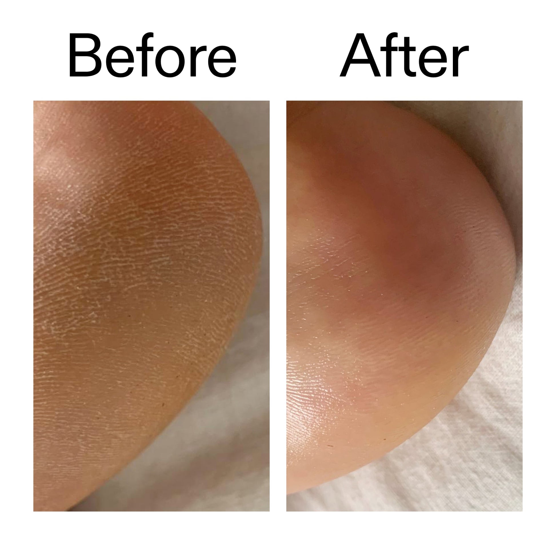glycolic-acid-exfoliating-body-stick-h1 Glycolic_Acid_Exfoliating_Body_Stick_Before_After_V1_2000x2000_a3043625-9400-429a-a7fb-d6dbd220f722.jpg