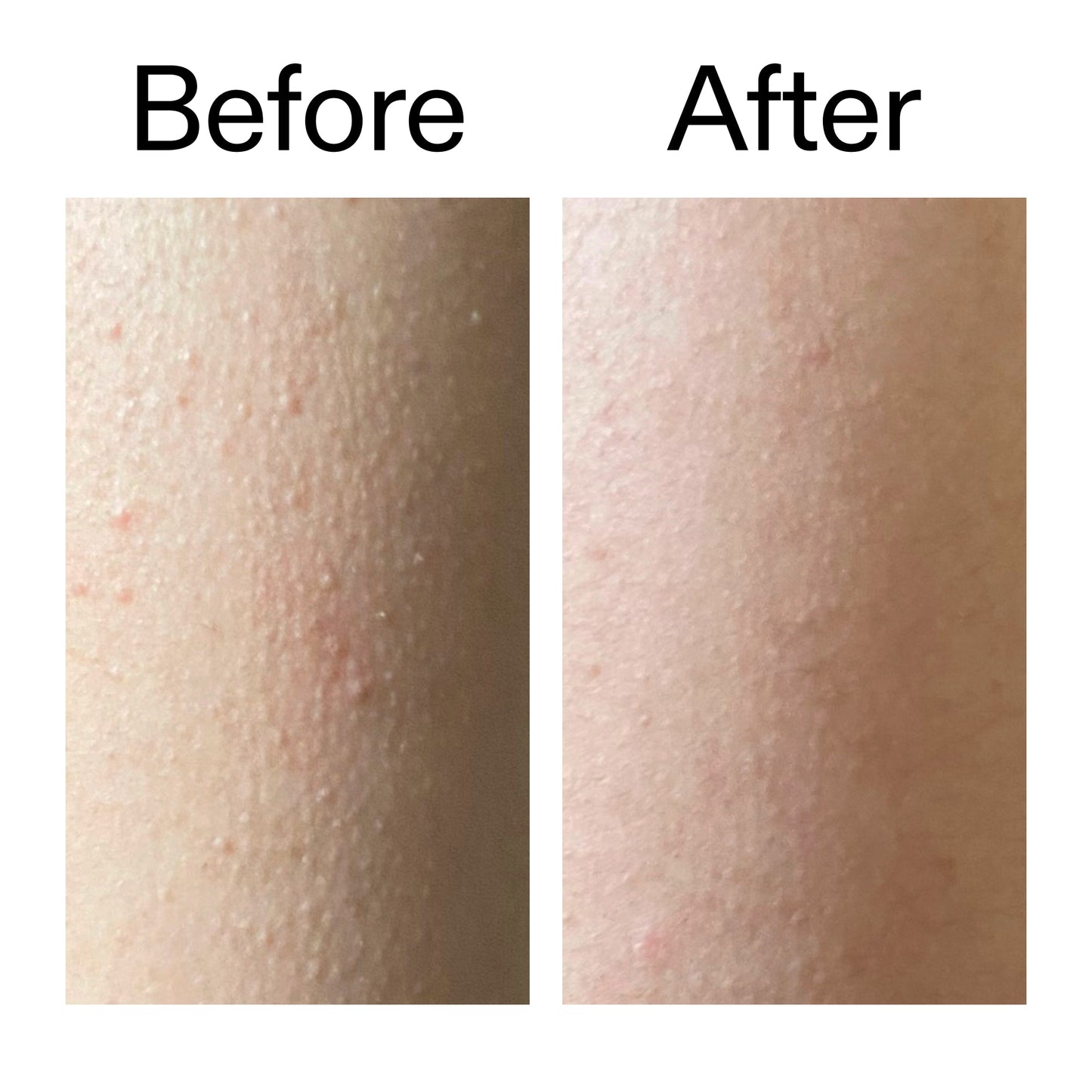 glycolic-acid-exfoliating-body-stick-h1 Glycolic_Acid_Exfoliating_Body_Stick_Before_After_V2_2000x2000_2e4ba052-94f6-4d56-82df-7bdb5b2df7ae.jpg