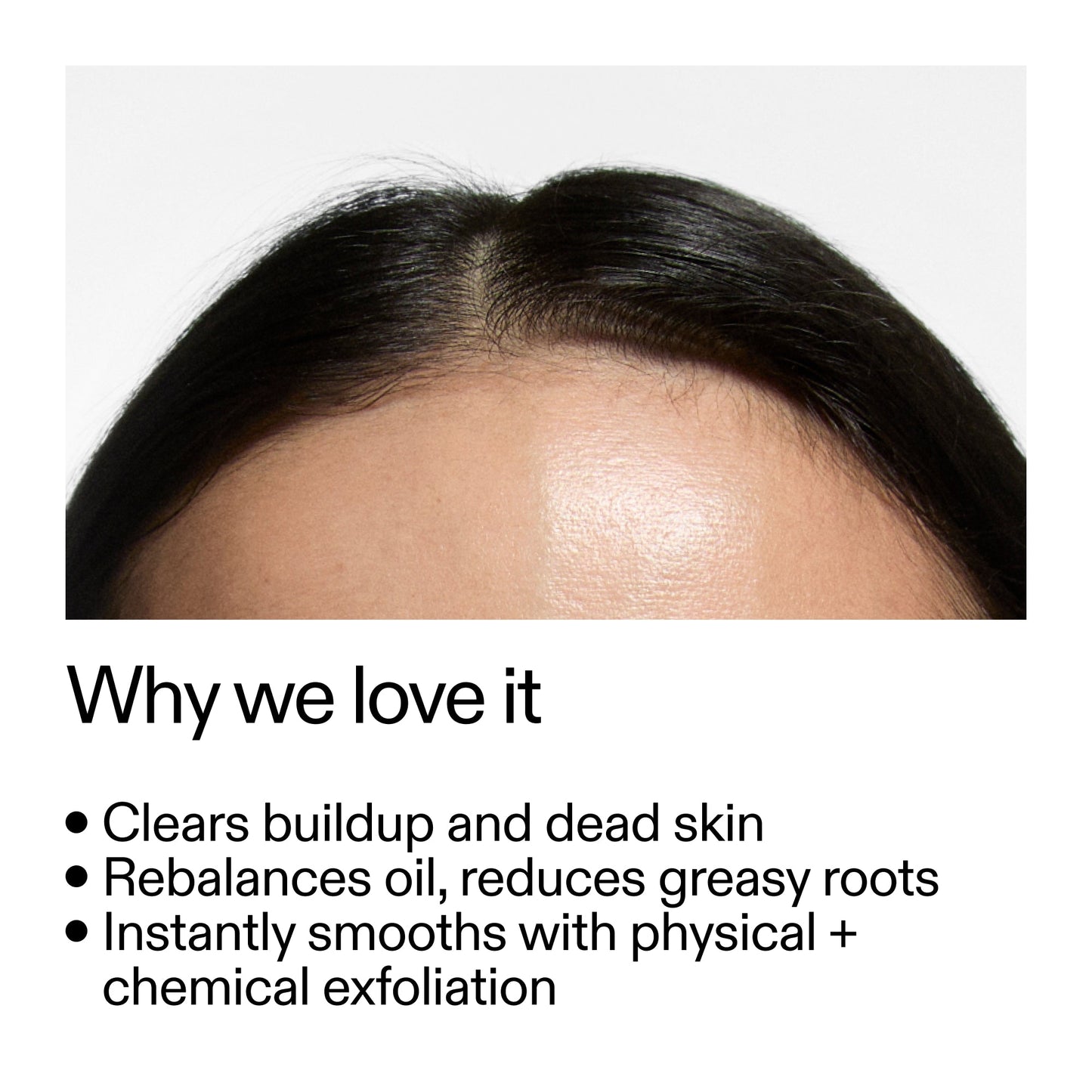 glycolic-acid-exfoliating-scalp-scrub-m5 Glycolic_Acid_Exfoliating_Scalp_Scrub_Why_we_love_it_2000x2000_46f65fb2-7d5a-4610-9788-873f5cb54602.jpg