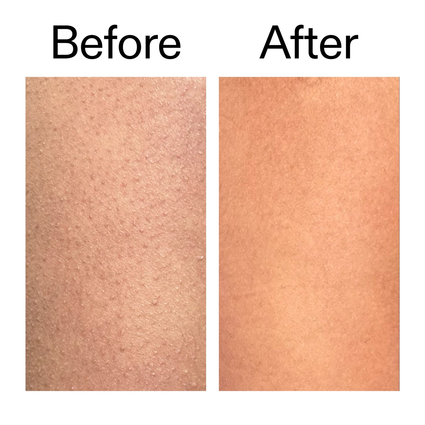 glycolic-acid-exfoliating-body-stick-duo-g1 Glycolic_Body_Stick_B_A_2000x2000_6e6e6b4d-5bd7-43c0-aeed-4d66788e8995.jpg