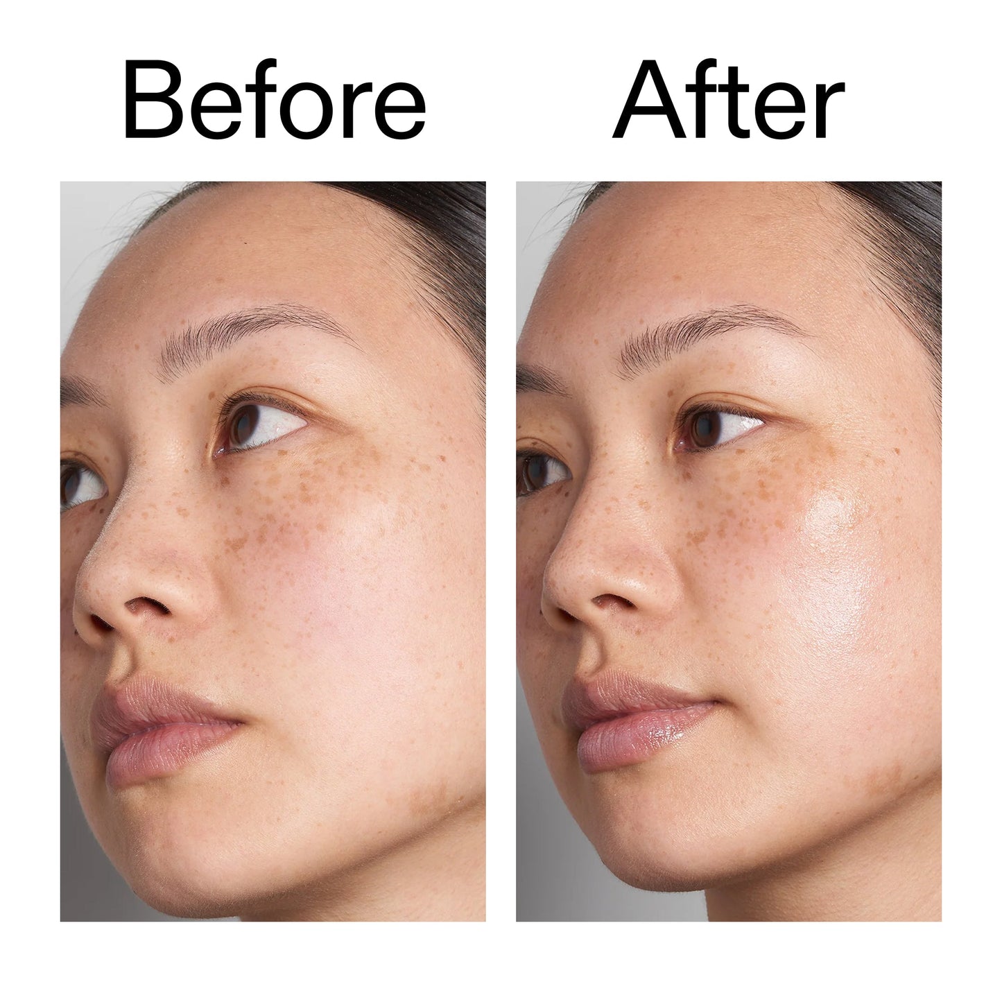 supersize-hyaluronic-acid-serum-100ml-x0 Hyaluronic_Acid_Before_After_2000x2000_d7983956-8aa2-4ea3-8255-c63e8d4f892e.jpg