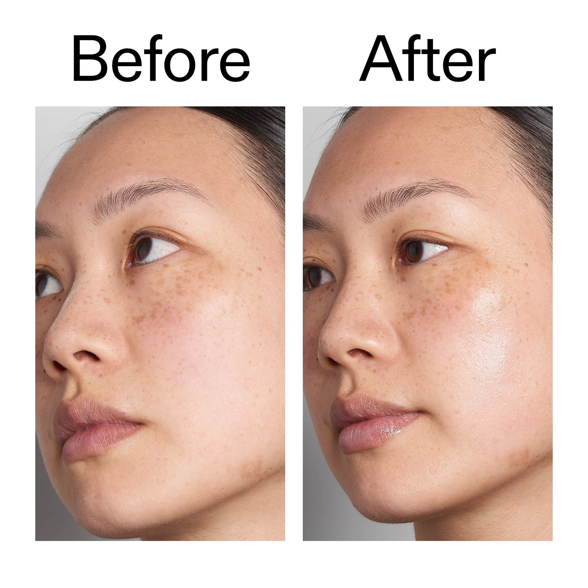 hyaluronic-acid-serum-30ml-j8 Hyaluronic_Acid_Before_After_2000x2000_d7983956-8aa2-4ea3-8255-c63e8d4f892e.jpg