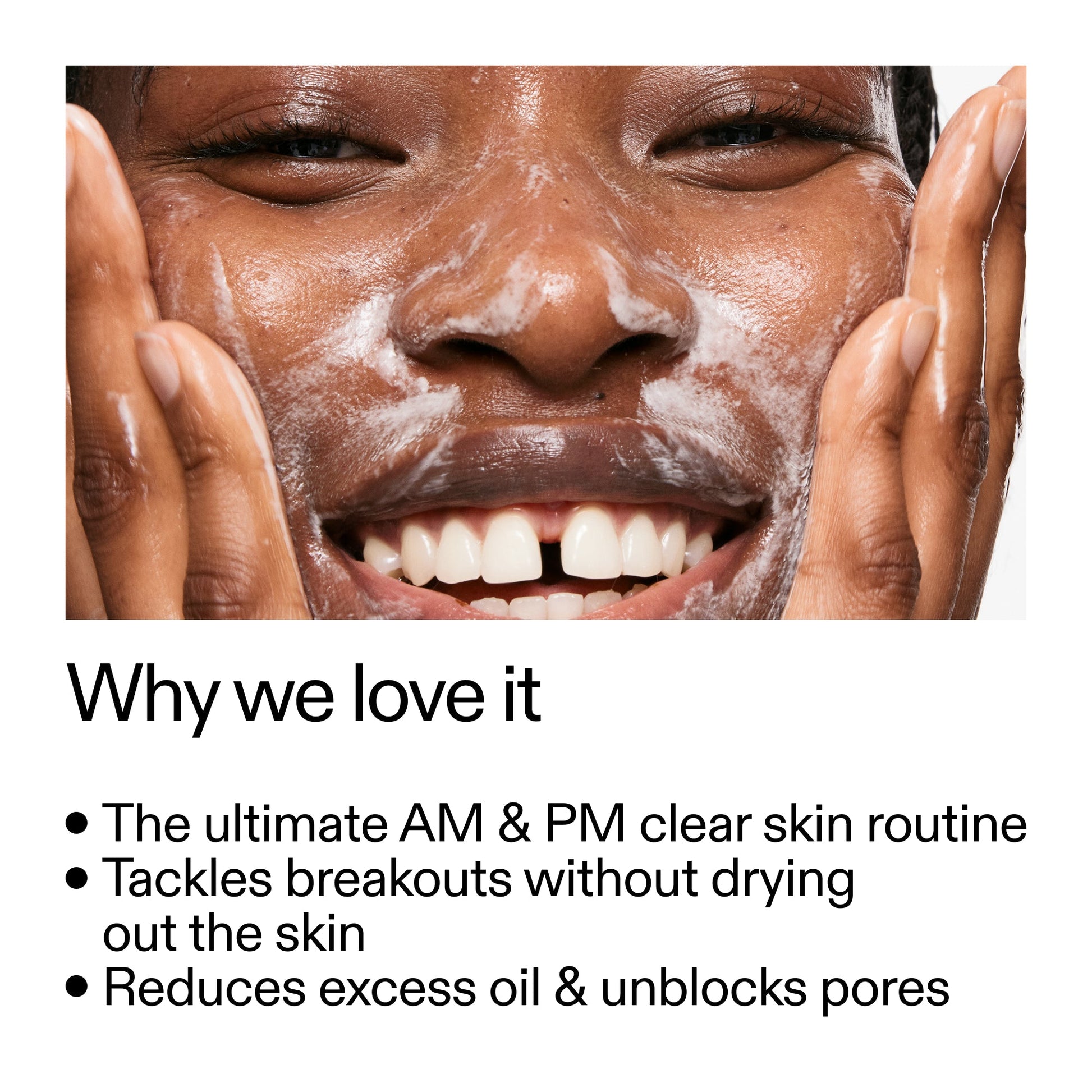 intro-routine-for-acne-h1 Intro_Routine_for_Acne_Why_we_love_it_2000x2000_42499e10-4629-4a0e-a627-7e215f4da6bc.jpg