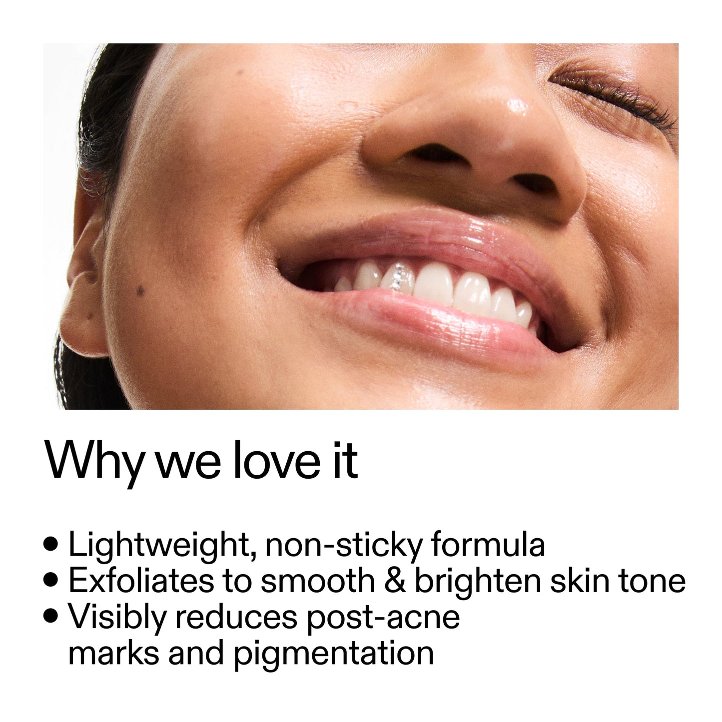 mandelic-acid-treatment-z2 Mandelic_Acid_Treatment_Why_we_love_it_2000x2000_6dfe29a9-2a79-464f-a5e8-e5ac37d93388.jpg