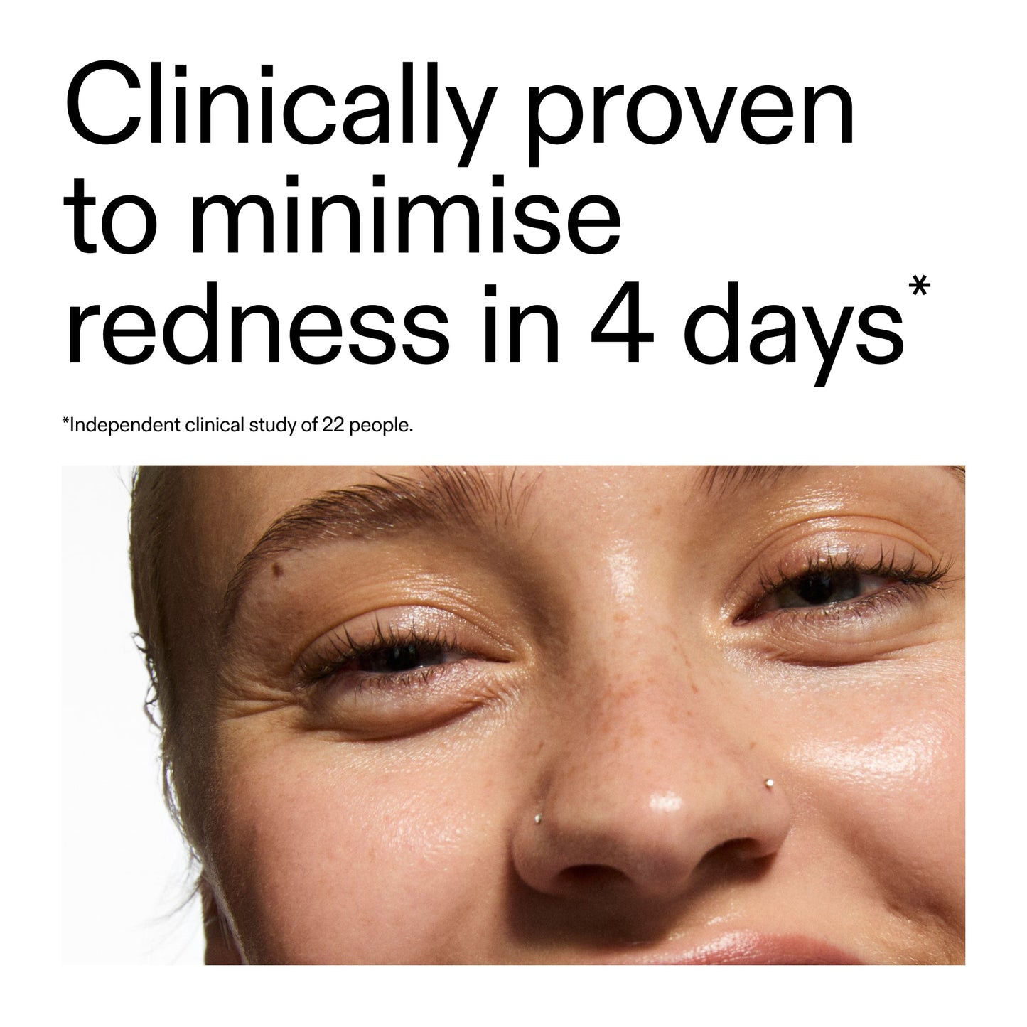 10-azelaic-acid-serum-for-redness-relief-f0 Oat_Cleansing_Balm_Claim_2000x2000_52a841dc-353c-4f2c-8646-3aadb604507d.jpg