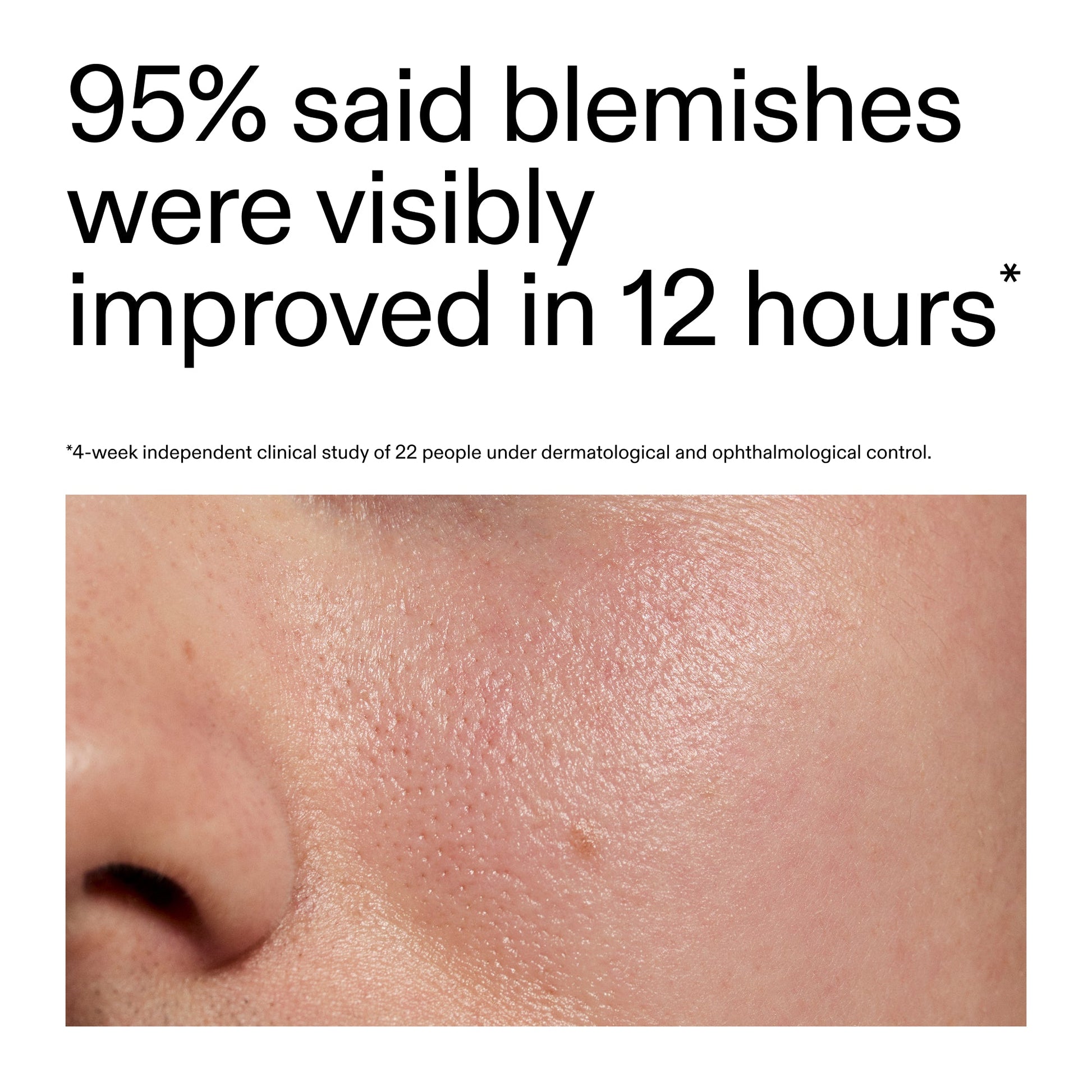 succinic-acid-acne-treatment-t8 Oat_Cleansing_Balm_Claim_2000x2000_ac6ce553-25db-41b2-a981-faae1ac4b8c0.jpg