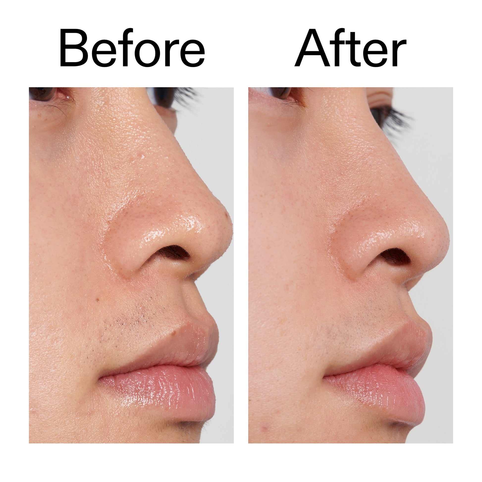 pha-toner-g3 PHA_Toner_Before_After_2000x2000_e3c10172-0150-4342-8b95-57417eaff50d.jpg