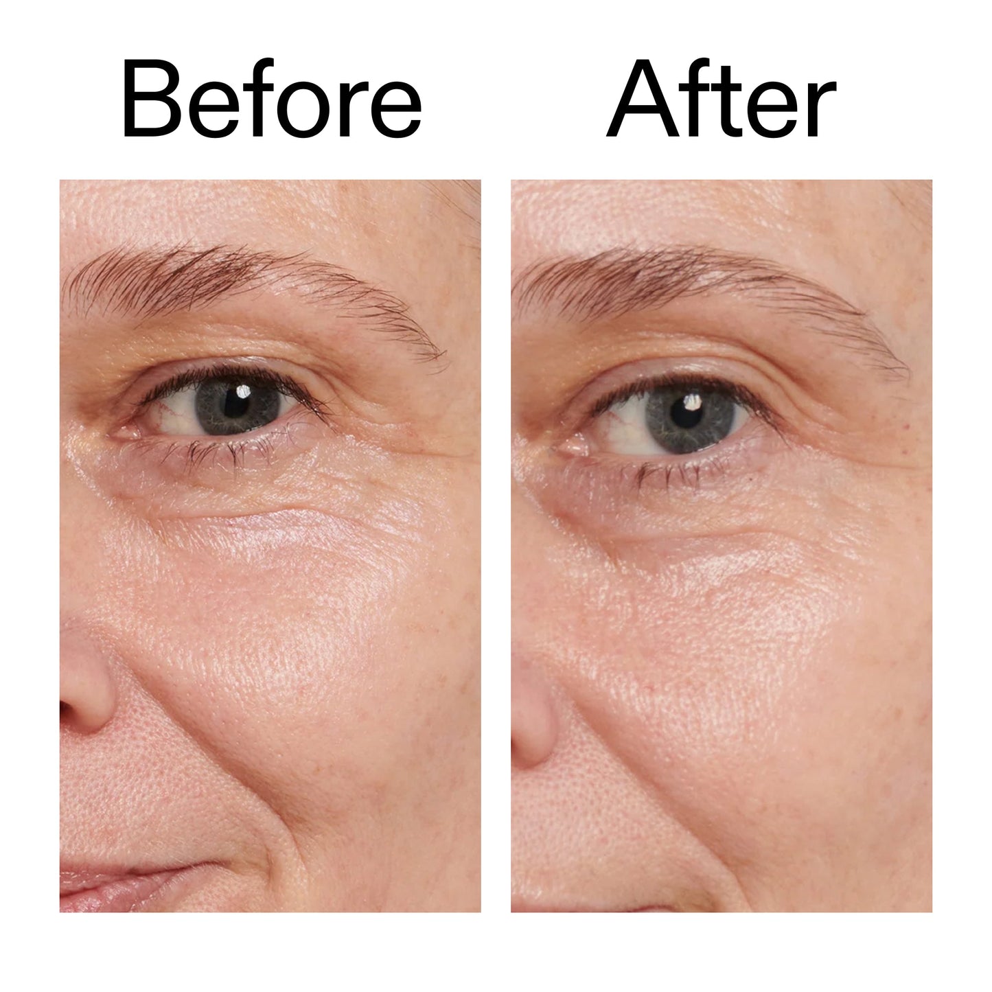 retinol-eye-cream-c2 Retinol_Eye_Cream_Before_After_2000x2000_ac03a80c-109e-4572-a95a-91dc109b4d27.jpg