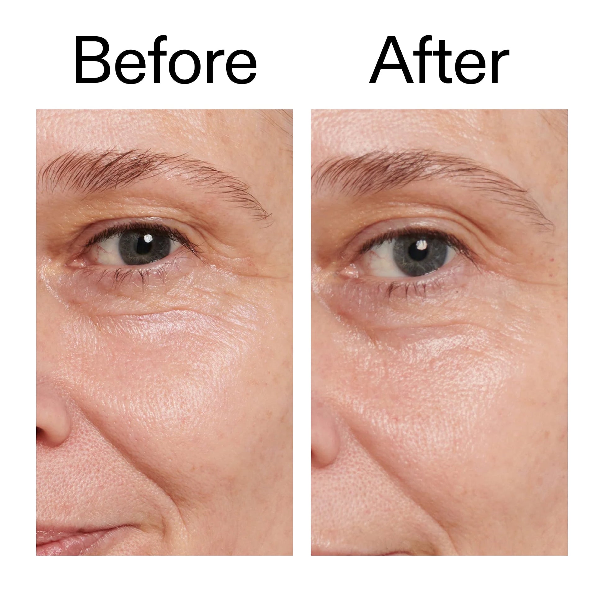 retinol-eye-cream-c2 Retinol_Eye_Cream_Before_After_2000x2000_ac03a80c-109e-4572-a95a-91dc109b4d27.jpg