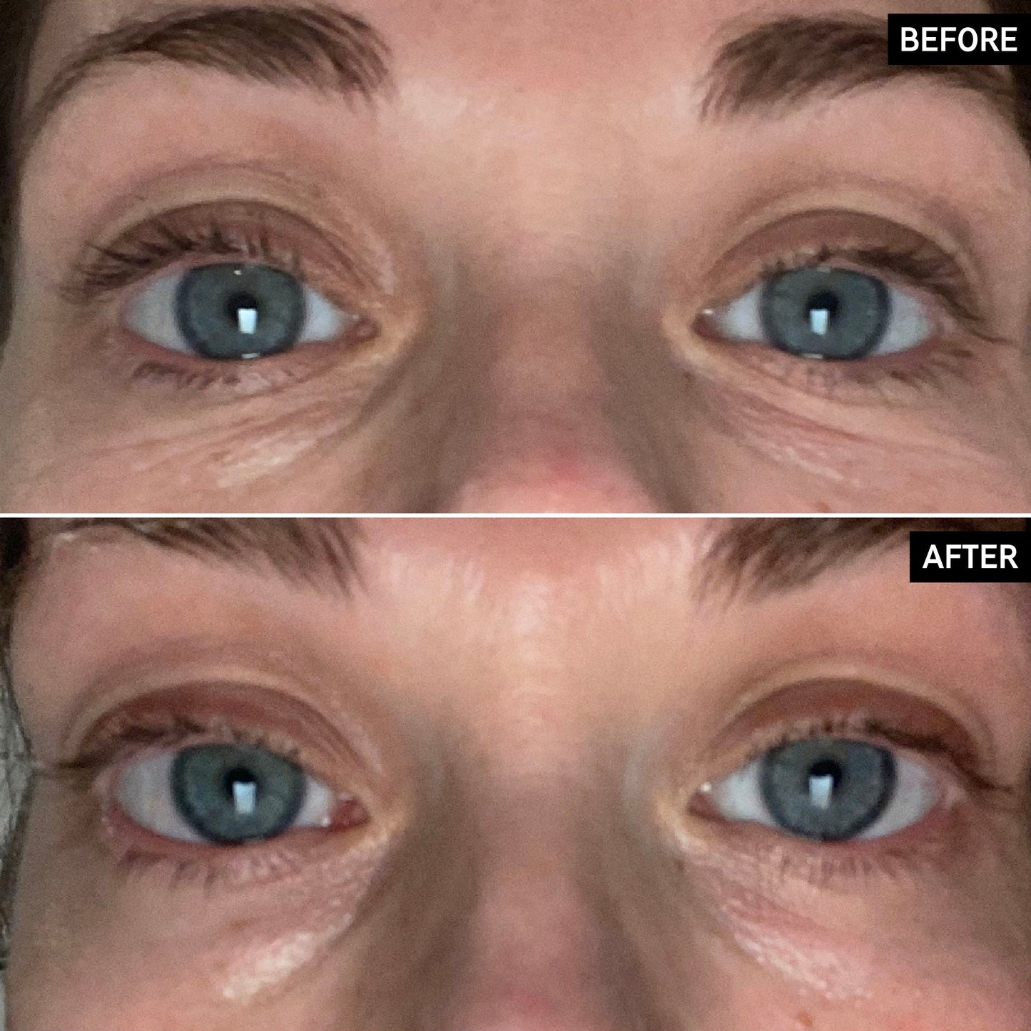 retinol-eye-cream-c2 SITE-UGCBAsApril_Nicole_B_A_PPage_2000x2000_1.jpg
