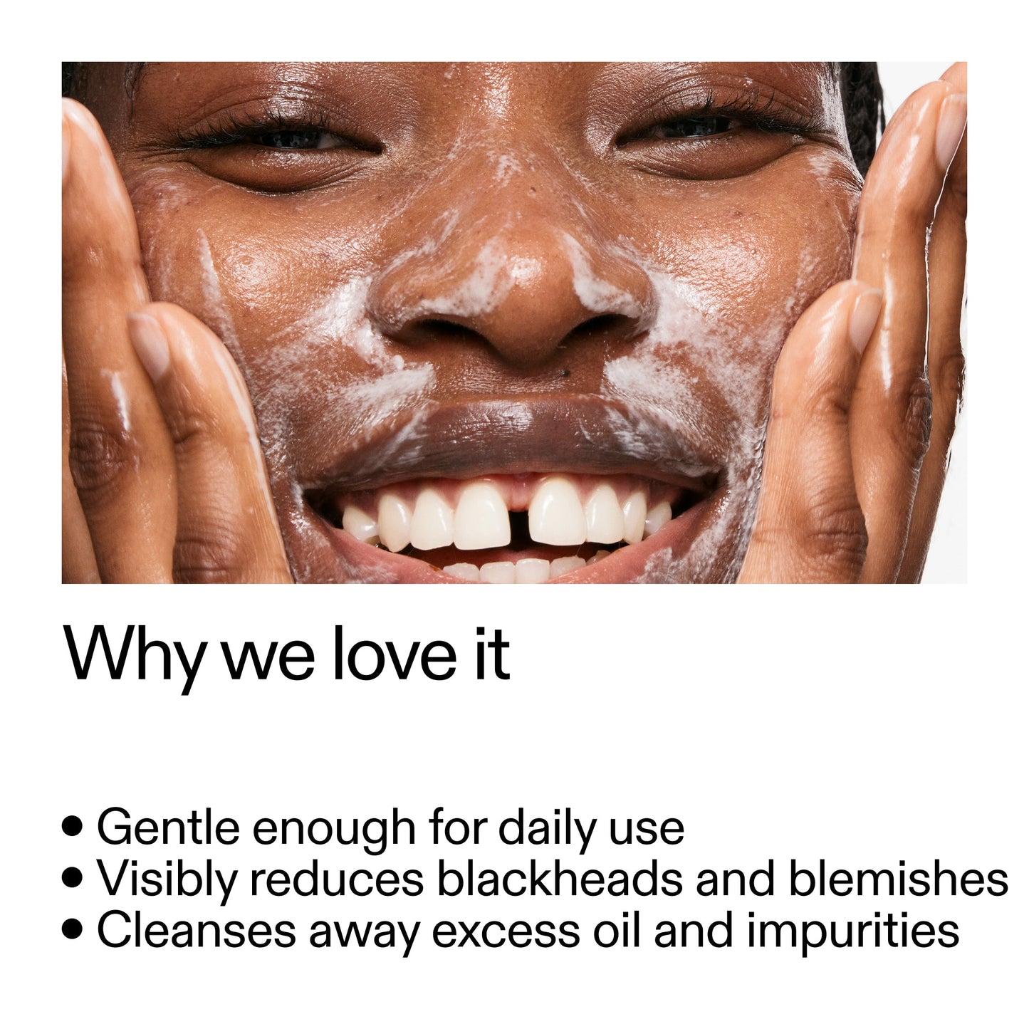 salicylic-acid-cleanser-150ml-b5 Salicylic_Acid_Cleanser_-_300mlWhy_we_love_it_2000x2000_87dc92a9-2559-4309-98cd-4e570f1be735.jpg