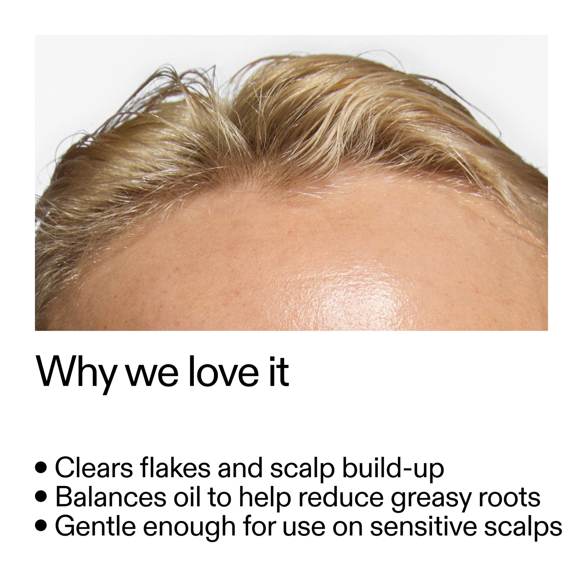 salicylic-acid-exfoliating-scalp-treatment-u9 Salicylic_Acid_Exfoliating_Scalp_Treatment_Why_we_love_it_2000x2000_44b6bd6d-9ec4-4b23-9dc4-bc3fd6f28e14.jpg