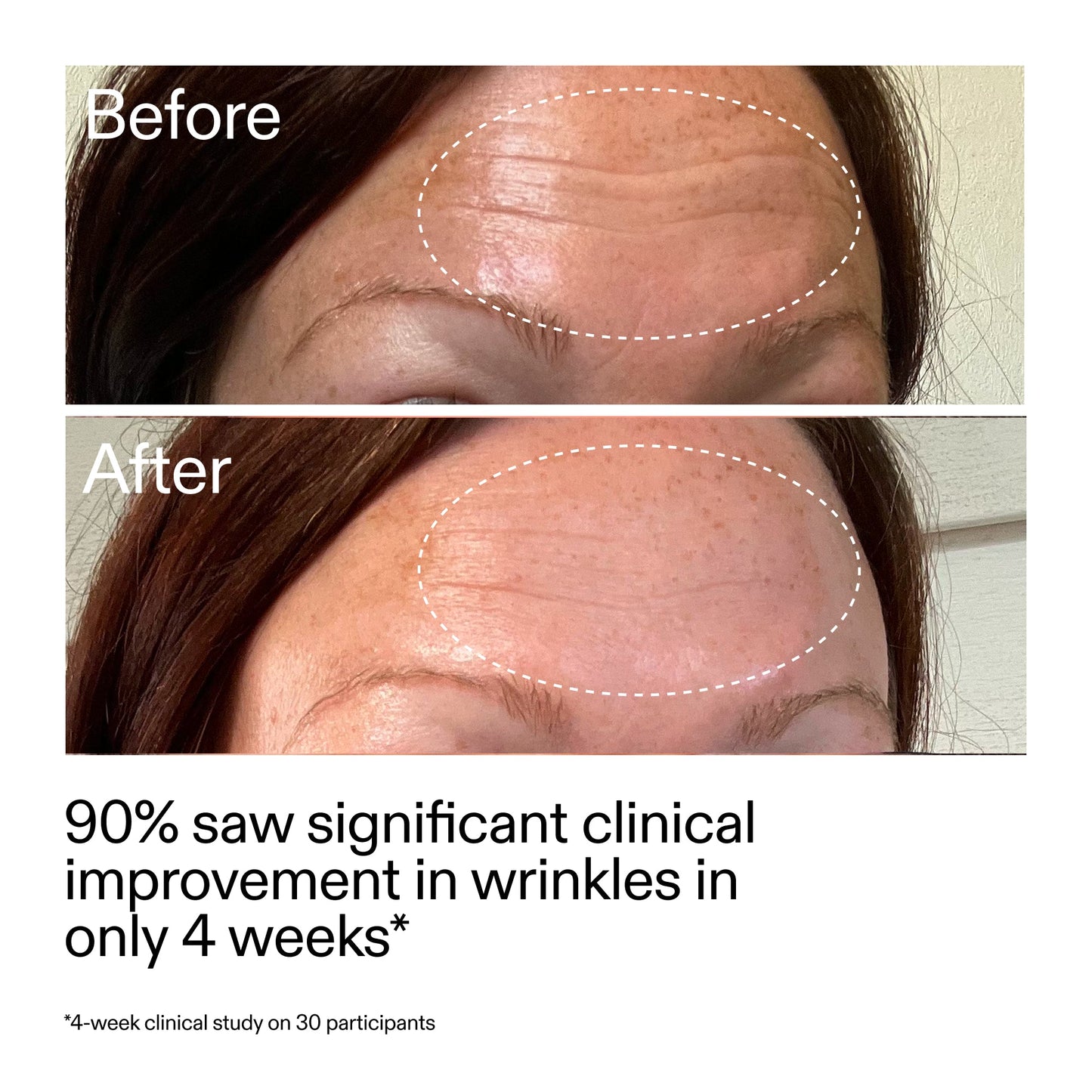 starter-retinol-serum-duo-d8 StarterRetinol_BeforeAfter_Claim1_2000x2000_03b4d6e5-a357-43b9-a855-aba5e35c57f3.jpg