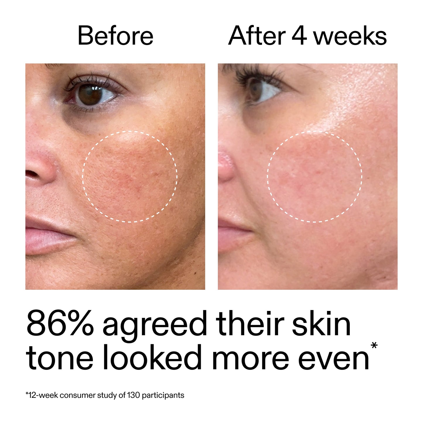 starter-retinol-serum-b2 StarterRetinol_BeforeAfter_Claim2_2000x2000_f5c9ecc0-8d76-429d-bef5-c3a61bcf5c09.jpg