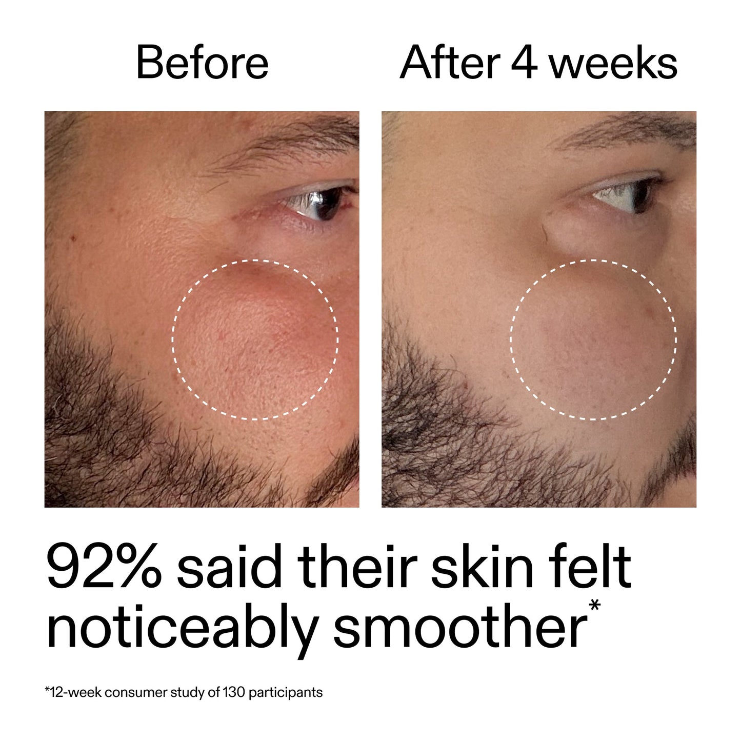 starter-retinol-serum-b2 StarterRetinol_BeforeAfter_Claim3_2000x2000_6ceab106-e0ee-4ed4-ba62-41bc39538038.jpg