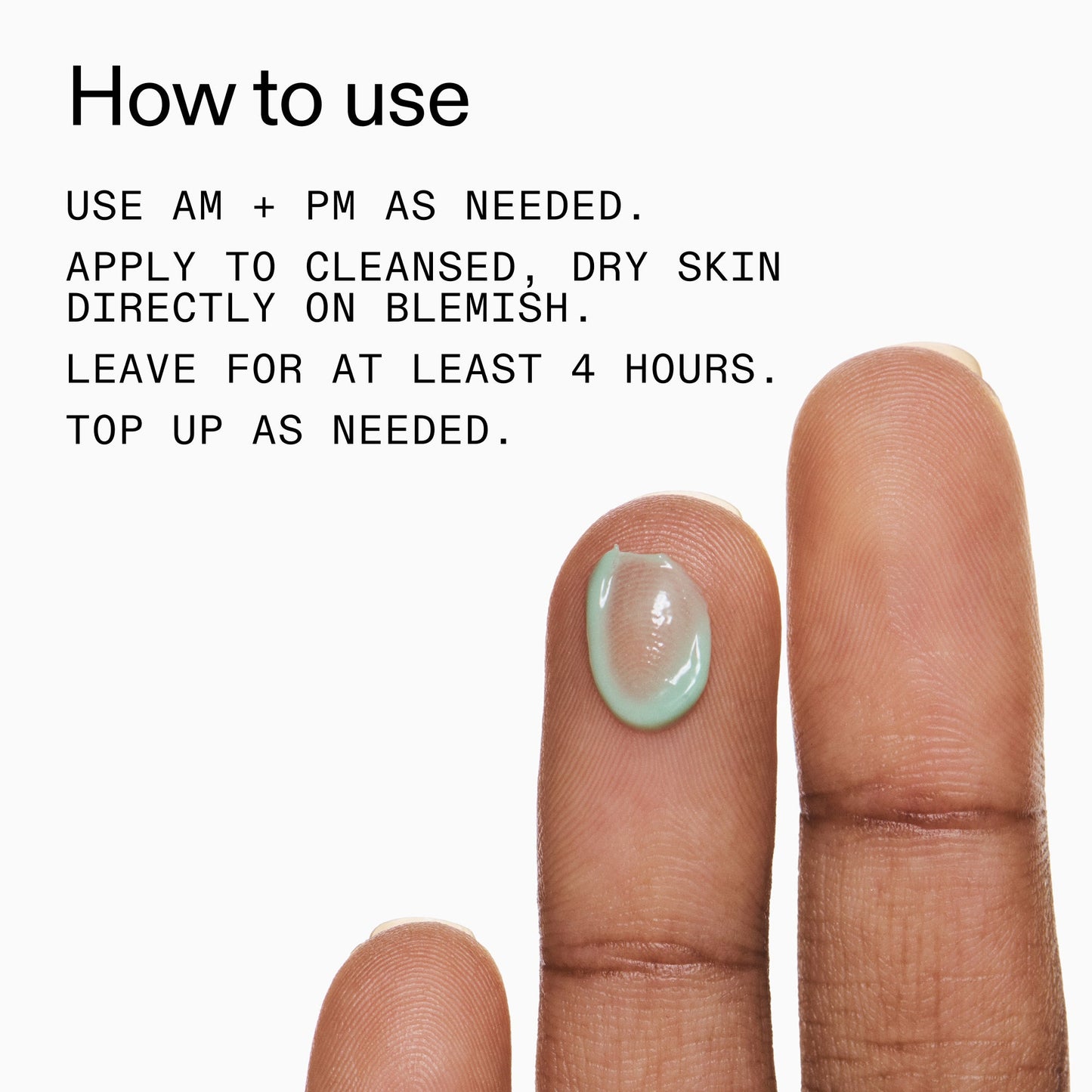 succinic-acid-acne-treatment-t8 Succinic_Acid_Treatment_How_to_Use_2000x2000_d57137d5-d7f1-427c-9a46-5fc00c19c542.jpg