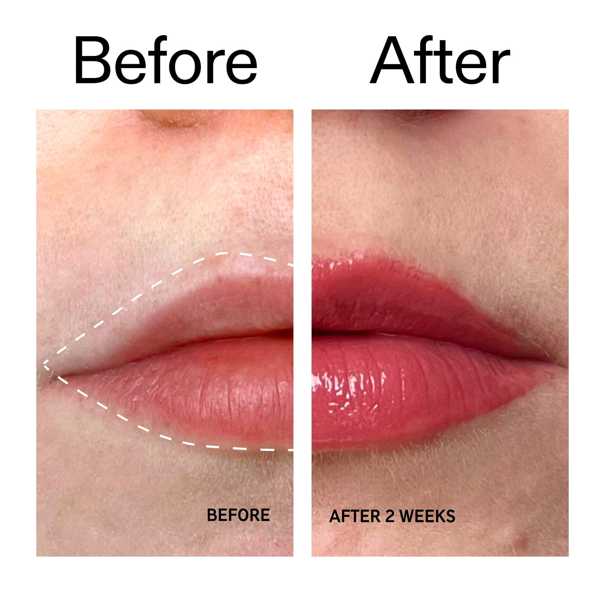 tripeptide-plumping-berry-lip-balm-k7 Tripeptide_Plumping_Lip_Balm_-_Berry_Before_After_2000x2000_9474bbd8-43ca-4b0e-b0e7-dfab70b91927.jpg