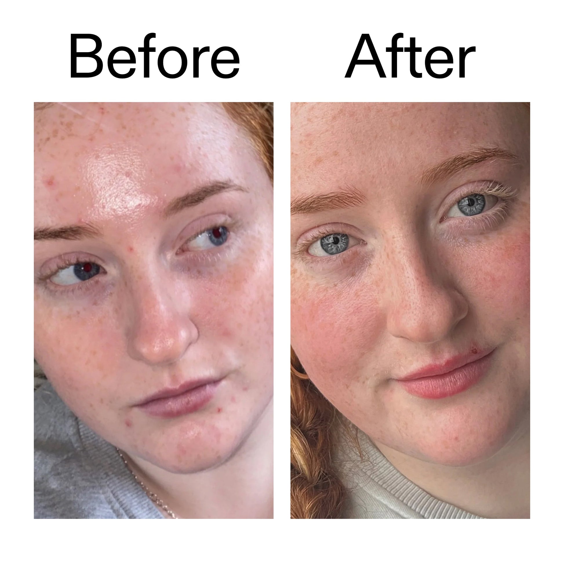vitamin-b-c-and-e-moisturizer-o8 Vitamin_B_C_and_E_Moisturizer_Before_After_2000x2000_b0781a76-5ad2-4be9-95b8-ef92b356833c.jpg